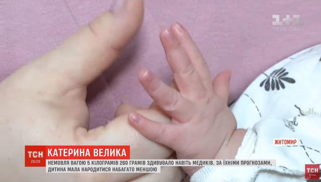 В Житомире родилась девочка-гигант