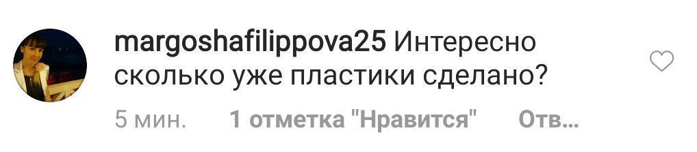 "Скільки пластики зроблено?" Нове фото Лорак збентежило шанувальників