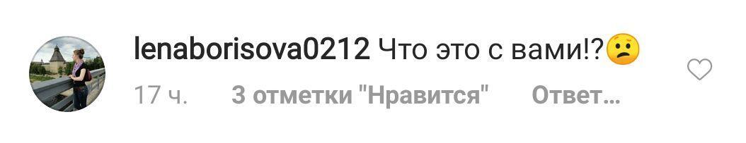 "Не може від "Текст" відійти": Асмус розлютила мережу дивними фото в міні