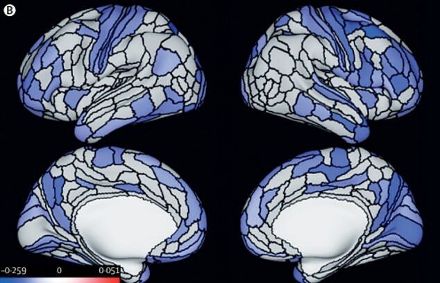 Снимки мозга участников исследования