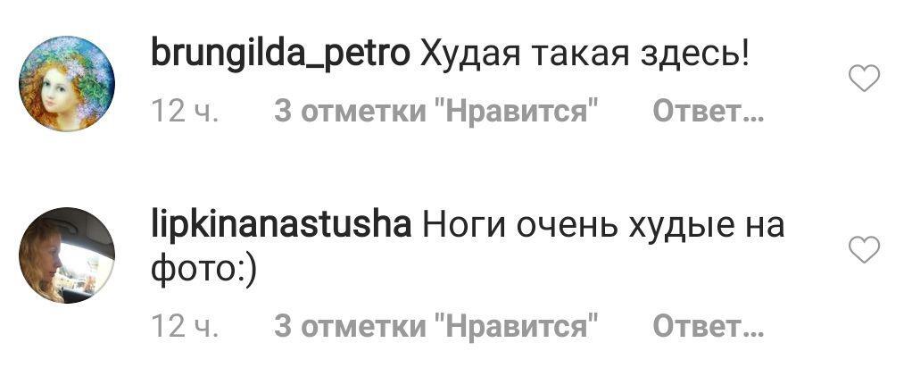 "Похоже на анорексию": Асмус ужаснула сеть слишком худыми ногами. Фото