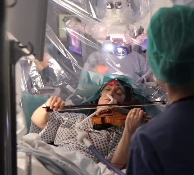 Женщина играла на скрипке во время операции на мозге