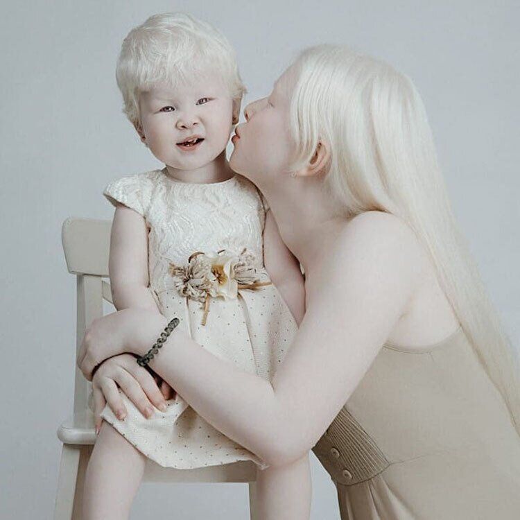 Сестры-альбиносы из Казахстана покорили мир необычной красотой. Фото