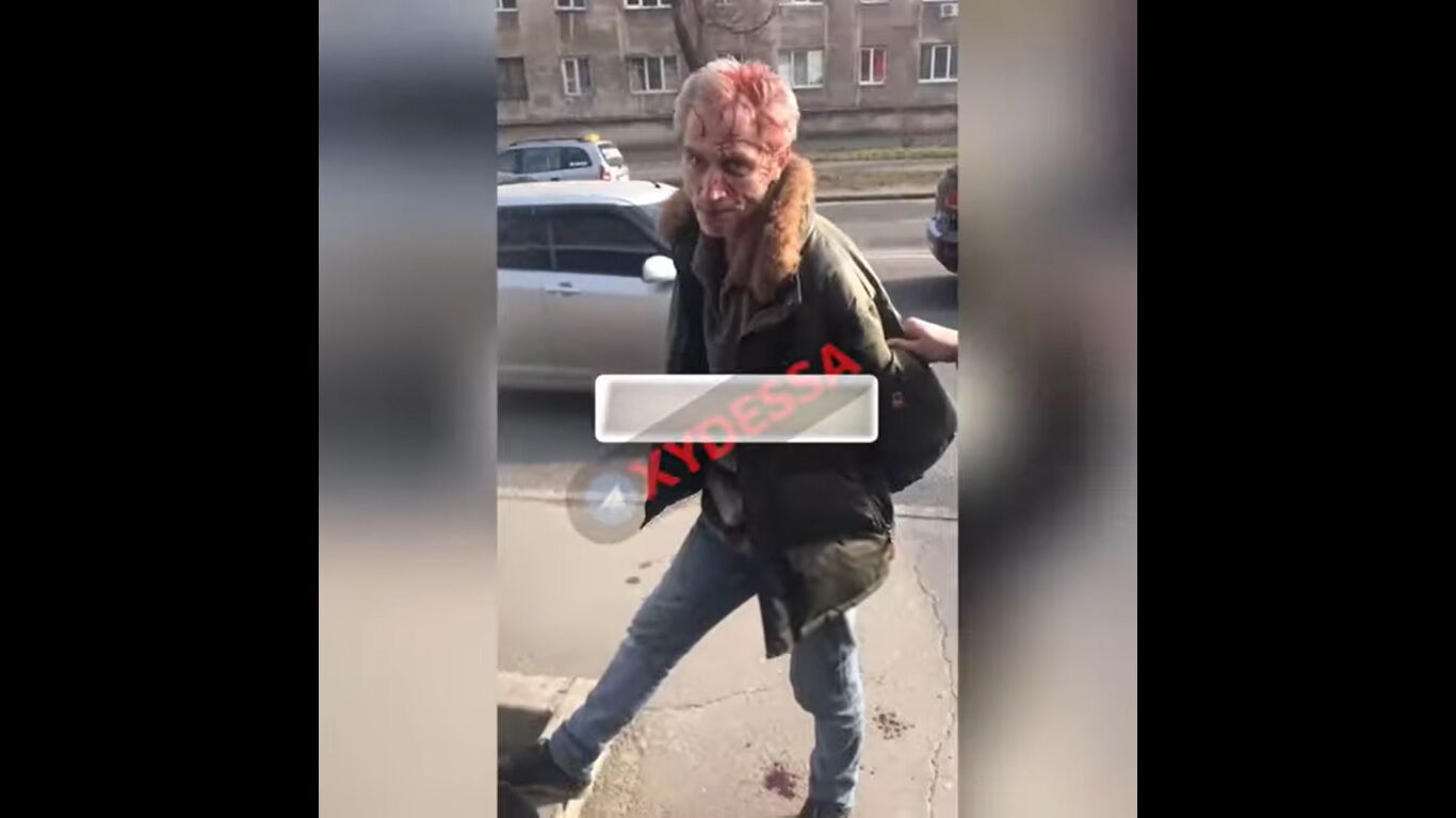В Одессе неадекват посреди улицы расстрелял семью прохожих