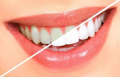 Раскрыта правда об эффективности отбеливающей зубной пасты