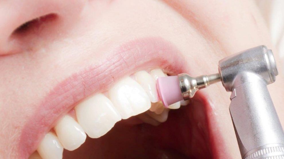 90% украинцев нуждается в услугах стоматолога: как уберечь свои зубы