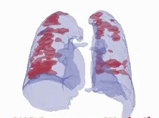 Коронавирус можно будет выявлять за 30 секунд: в Израиле взялись за разработку