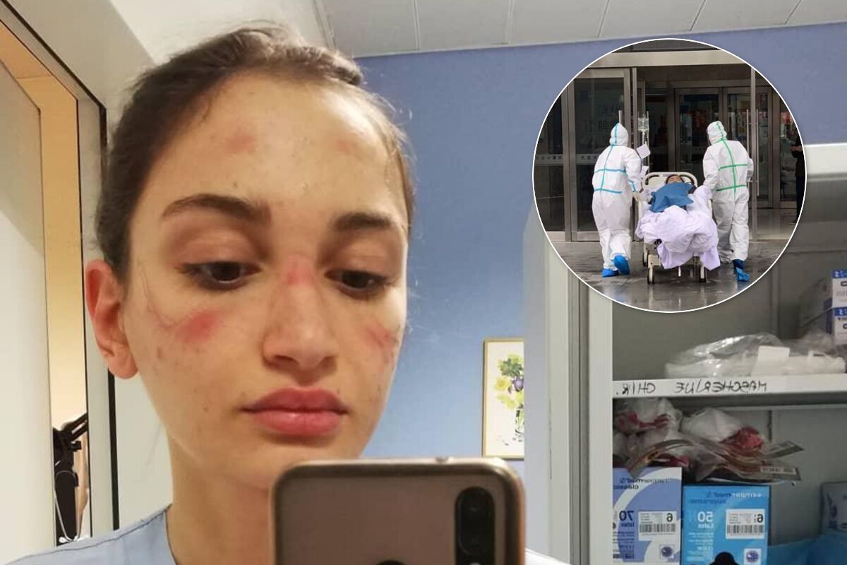 23–летняя медсестра Алессия Бонари из больницы Милана показала лицо после работы в маске