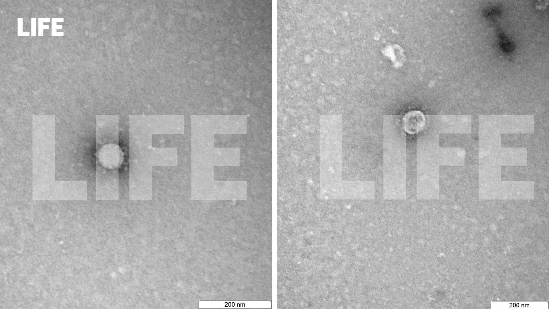 Как выглядит коронавирус под микроскопом: появились снимки
