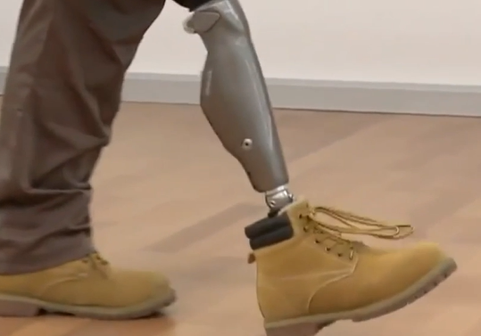 Чтобы вернуть протез, афганцу придется снова собирать документы и проходить тесты