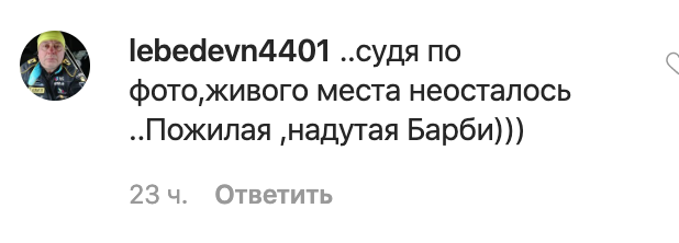"Живого места не осталось!" Пугачеву высмеяли за неудачный снимок