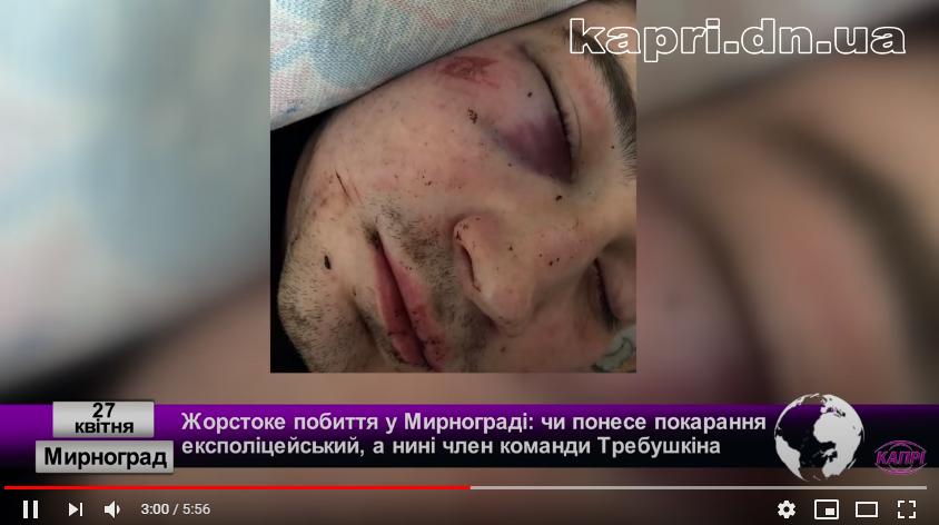 Зламані ніс та щелепа: на Донеччині експоліцейський жорстоко побив підлітка. Відео