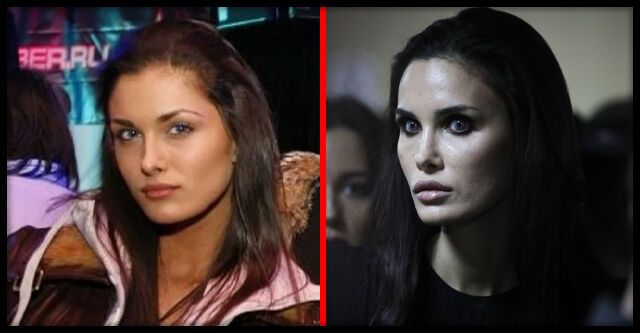 Алана Мамаева (до и после операции)