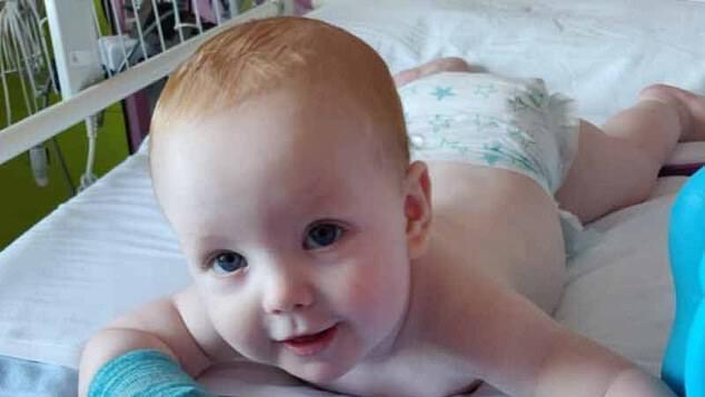 У Великобританії 8-місячний малюк став наймолодшою жертвою синдрому Кавасакі
