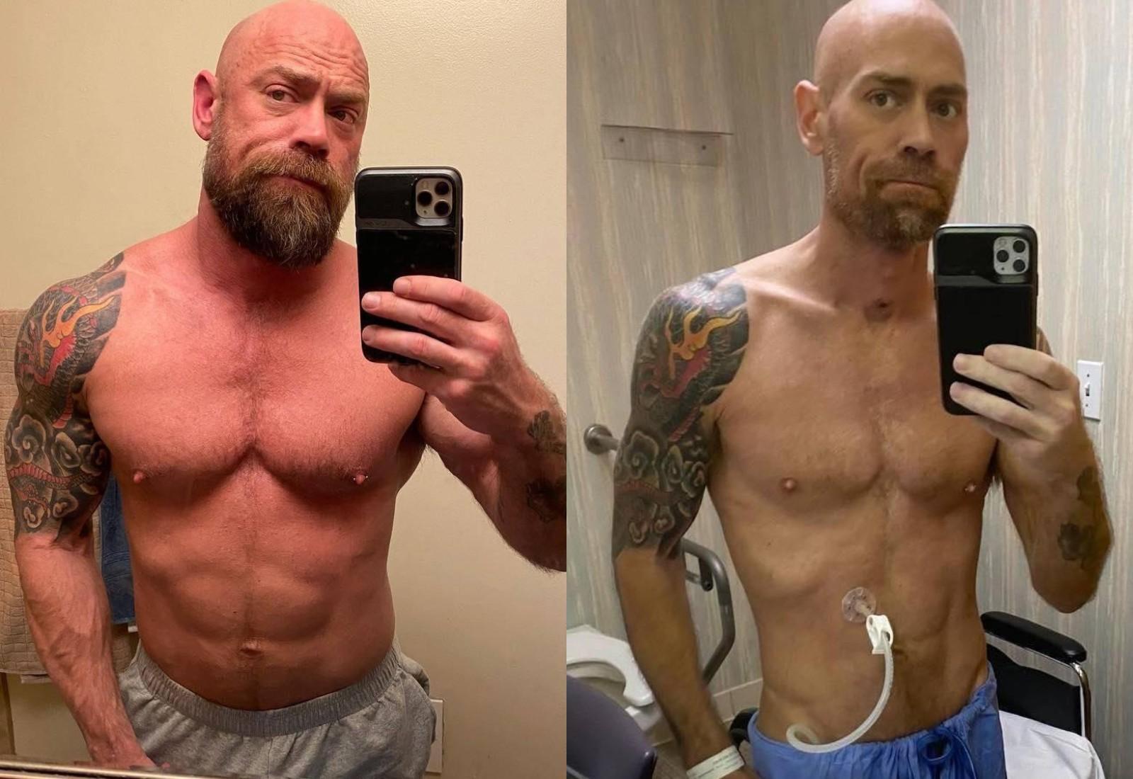 Медбрат из США за время болезни COVID-19 потерял 23 кг. Фото до и после