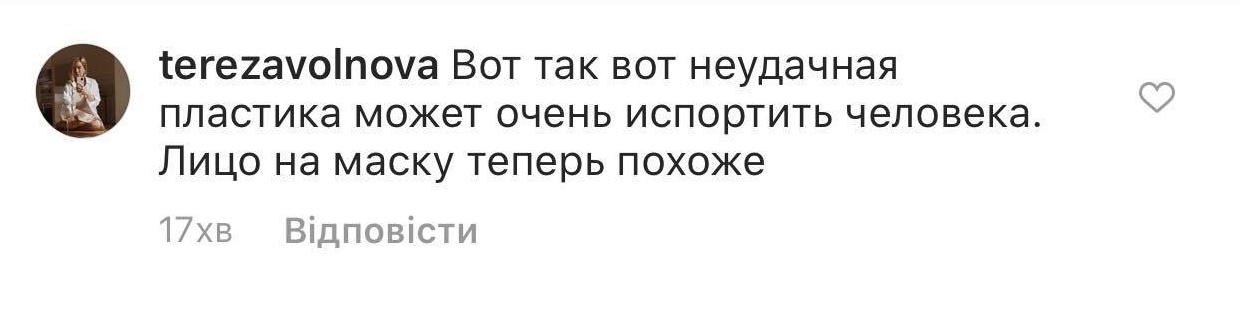 53-летнюю Овсиенко разнесли за неудачную пластику