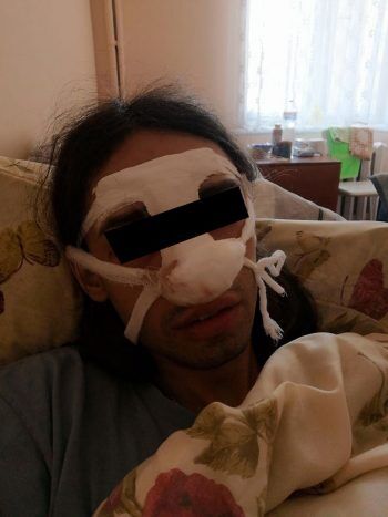 В Харькове трое мужчин напали на трансгендерную женщину