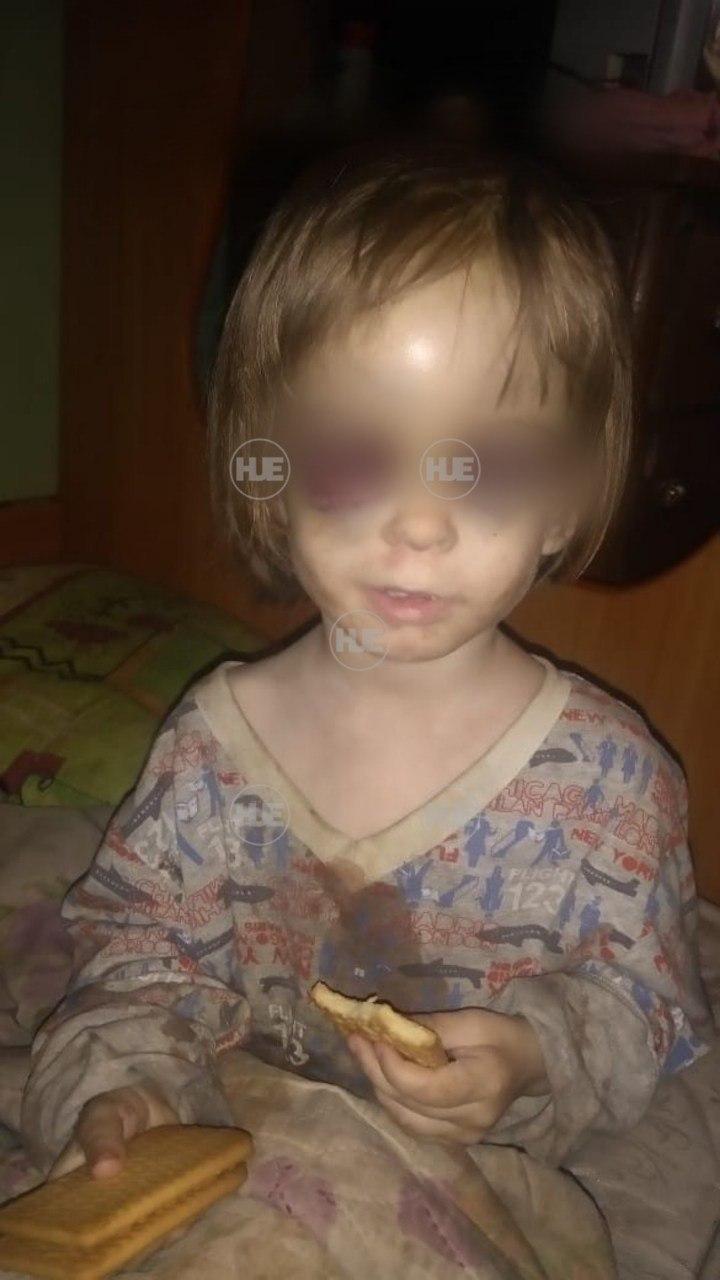 В России мать зверски избивала и морила голодом 2-летнюю дочь