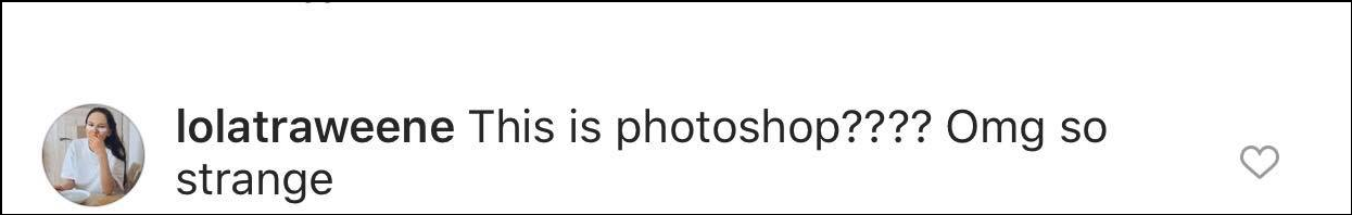 Сменившая цвет кожи девушка поразила аномальной худобой: откровенные фото