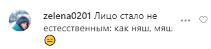 66-летнюю Успенскую разнесли за неудачную пластику