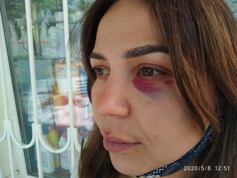 Пострадавшая Гузель Окорокова
