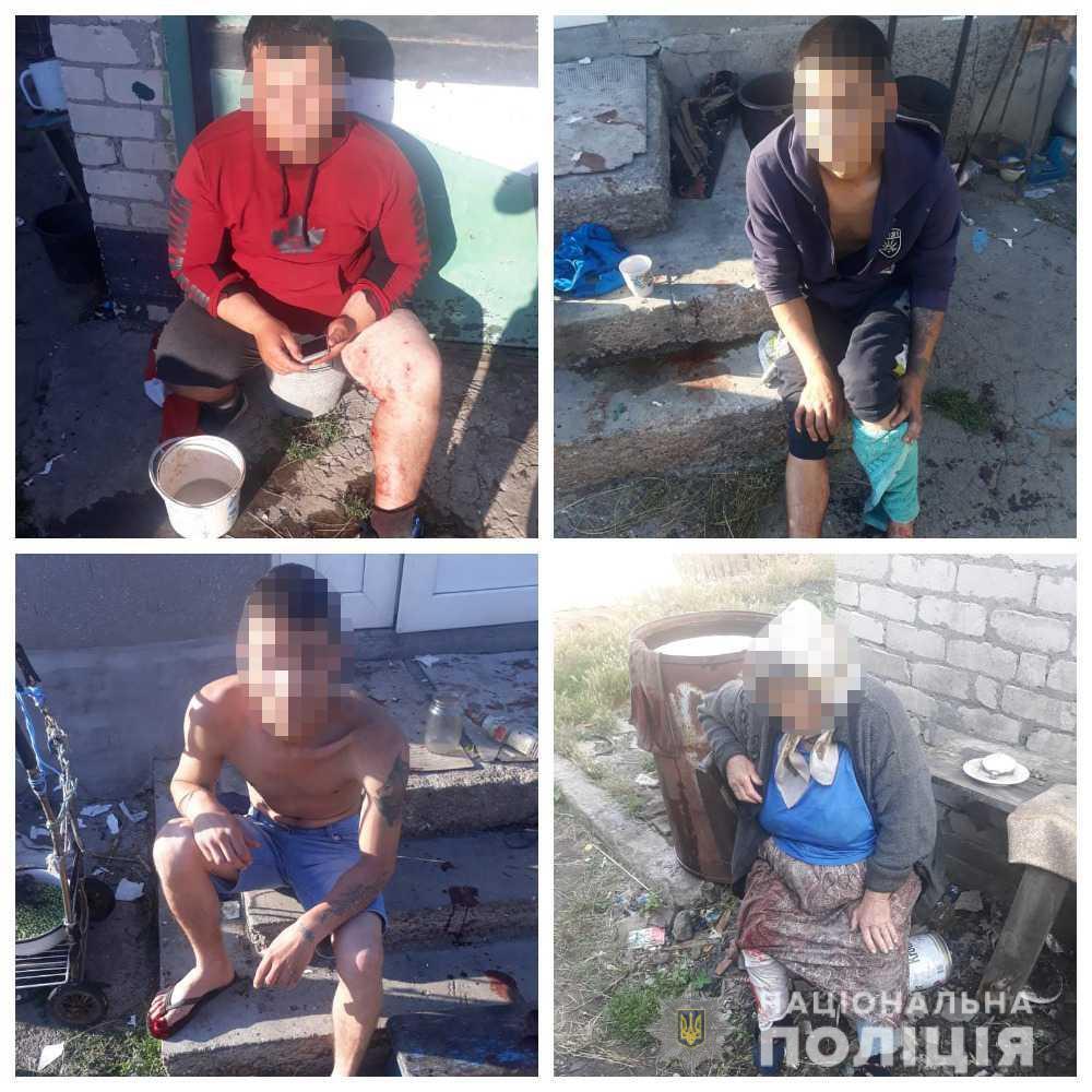 В Дачном Беляевского района взрыв гранаты ранил 5 человек