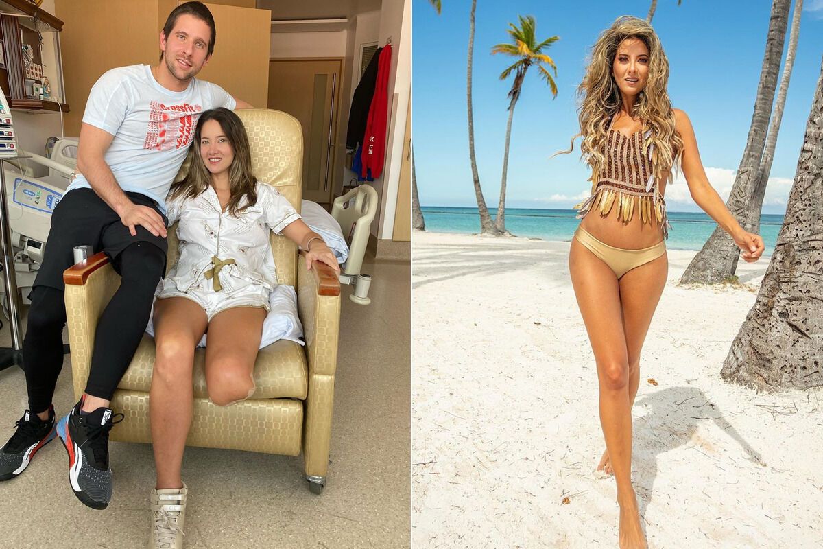 Участнице "Мисс Вселенная" ампутировали ногу: как выглядела девушка до операции. Фото