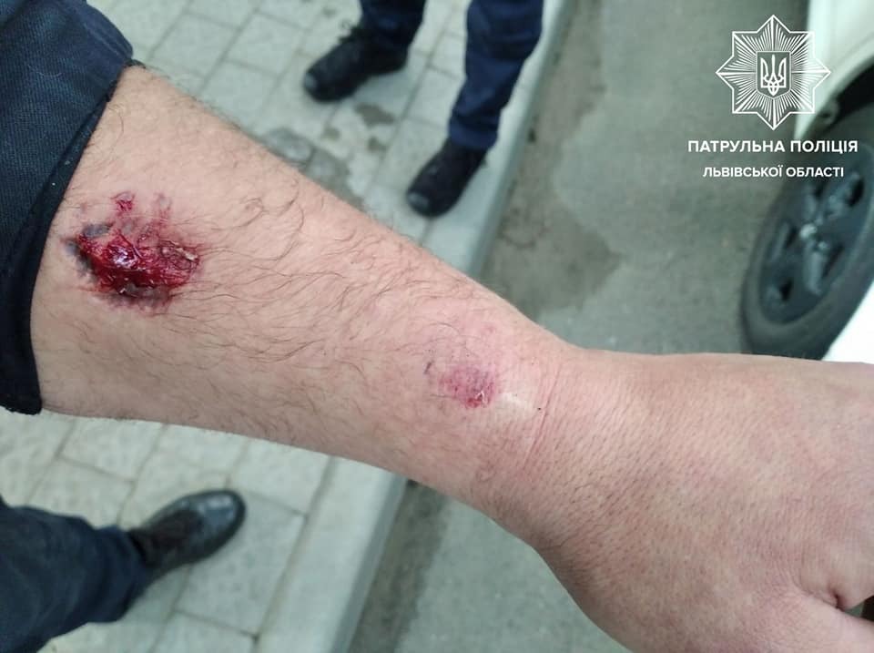 У Львові нетверезий водій вкусив патрульного за руку
