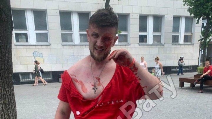 В Житомире избили представителя партии Шария: брызнул слезоточивым газом в ветерана "Азова". Видео
