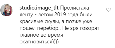 Блогерша из Киева поразила лицом после пластики: огромные скулы напугали сеть