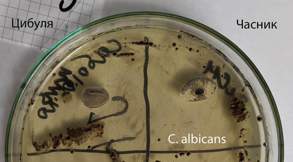 Часник і цибуля не вбивають бактерії