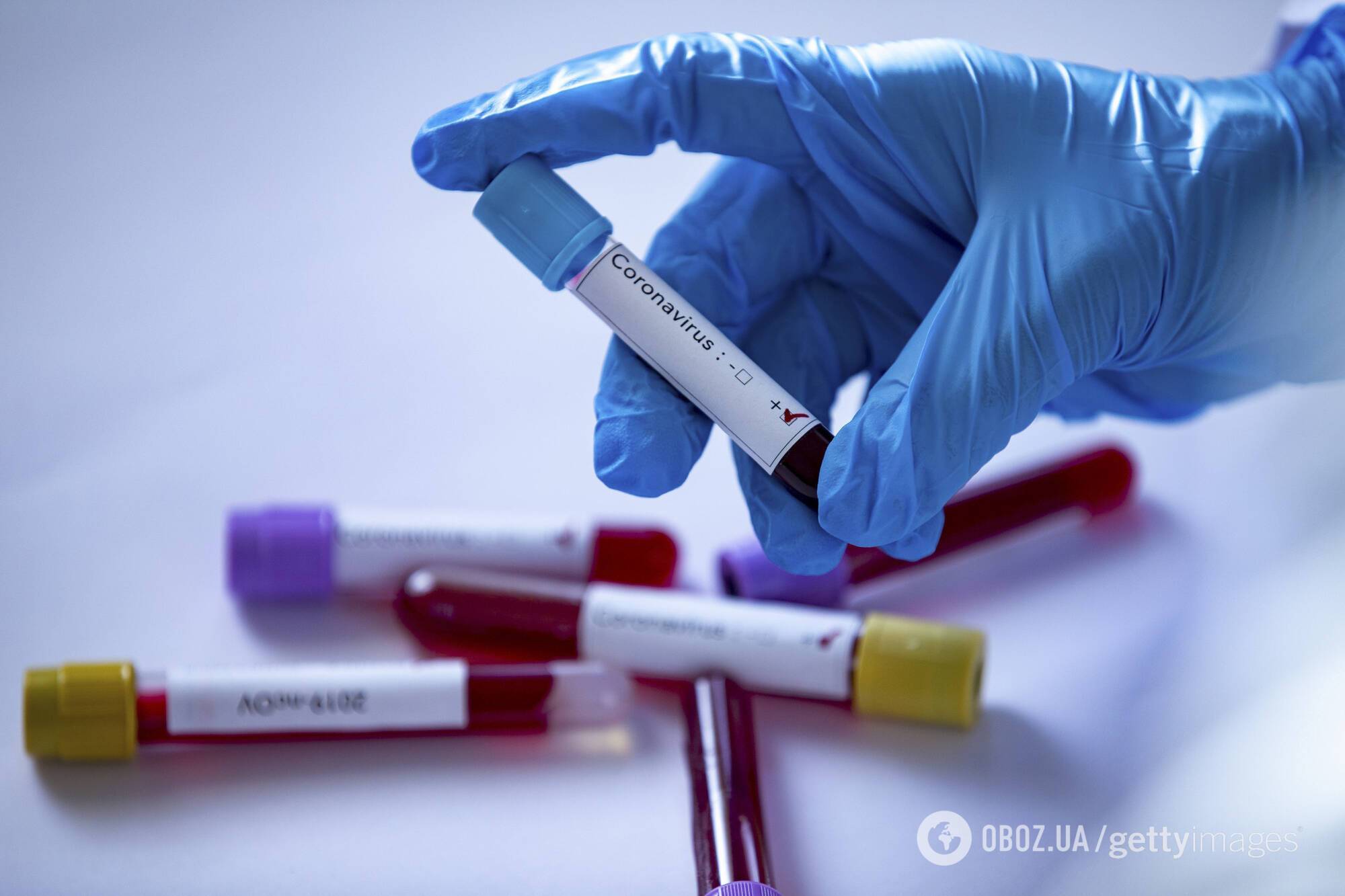 Вакцина от коронавируса может появиться в начале 2021 года