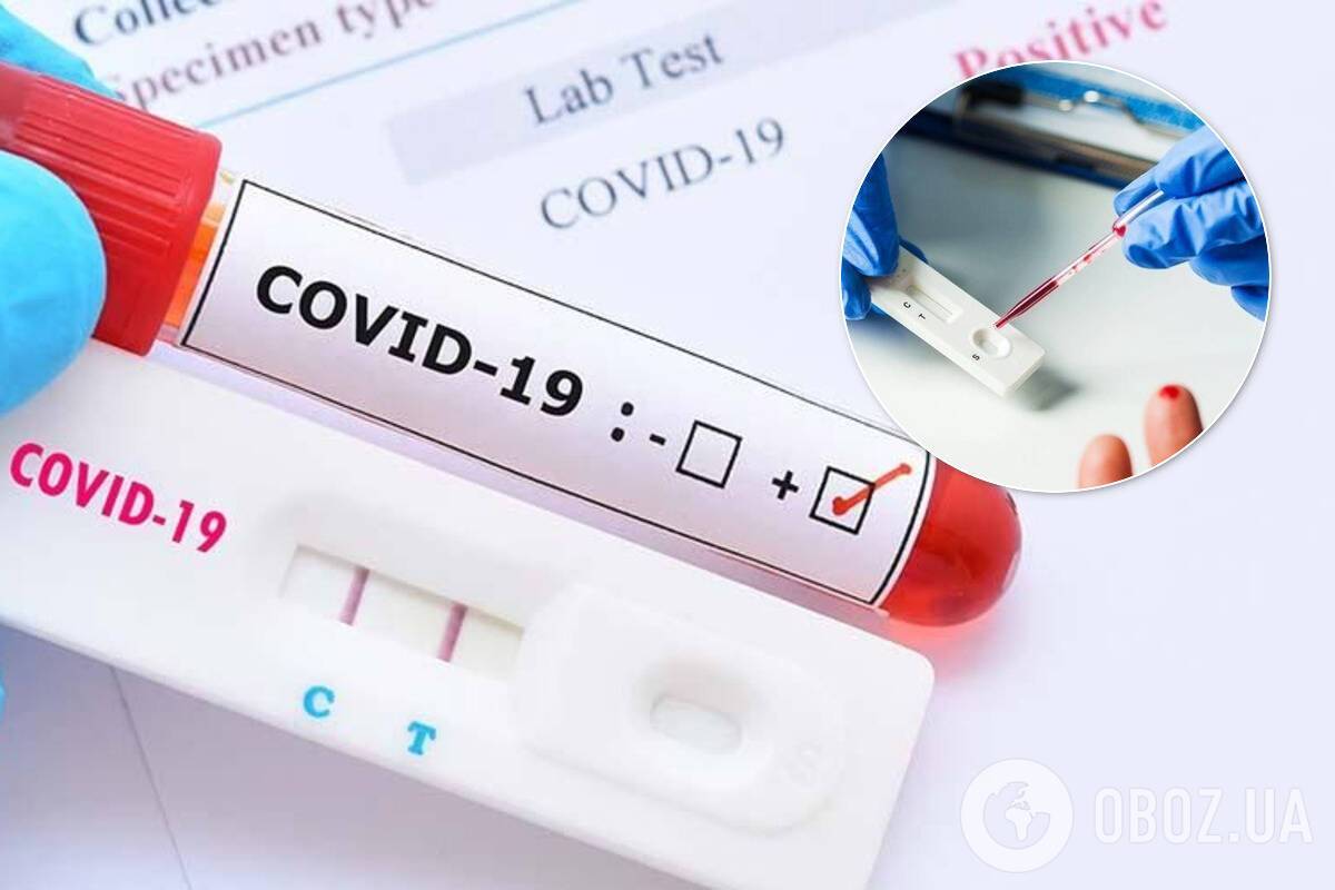 Тести на коронавірус відрізняються результатами