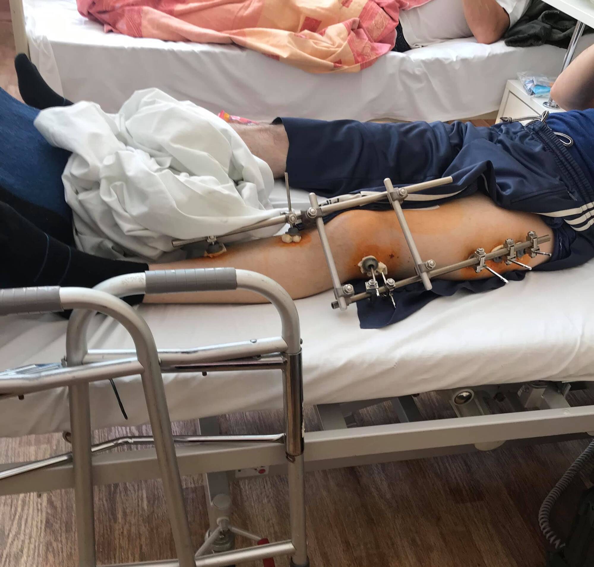 Раненый боец с Донбасса в Киеве
