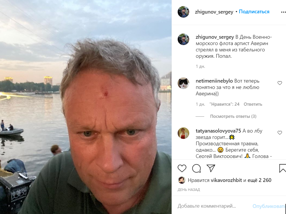 Актор Жигунов отримав поранення з табельної зброї
