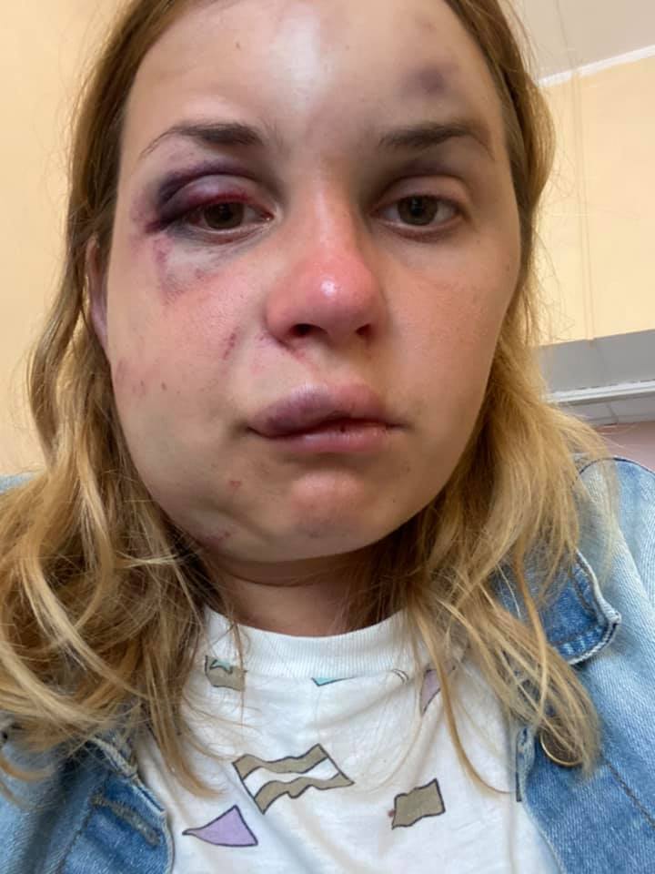 Анастасия Луговая рассказала о жестоком нападении в поезде