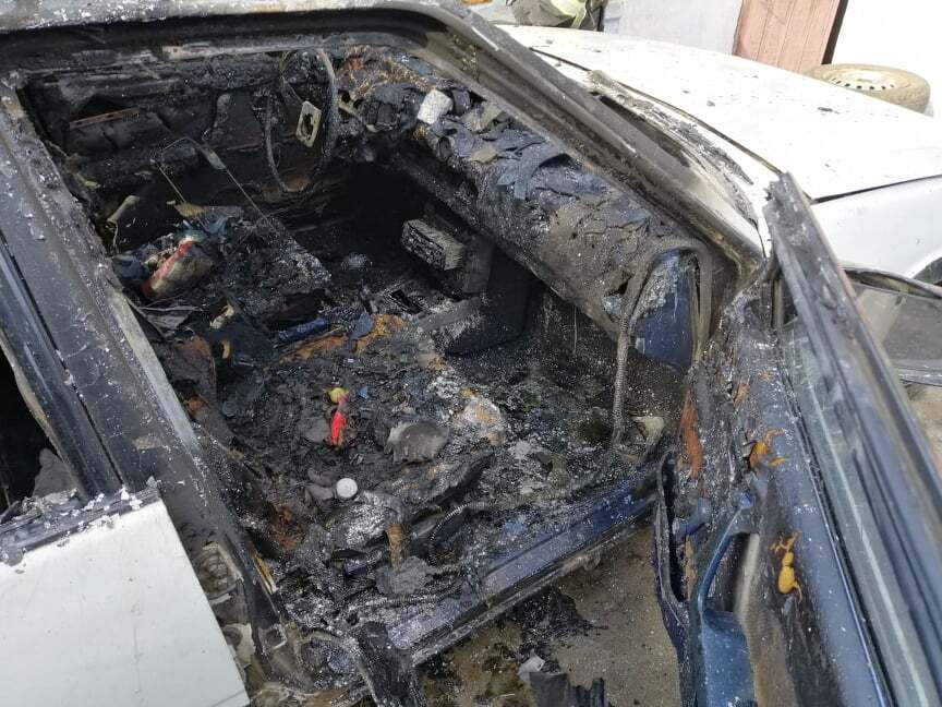 Автомобиль сгорел, а девочка, поджегшая его, получила сильные ожоги
