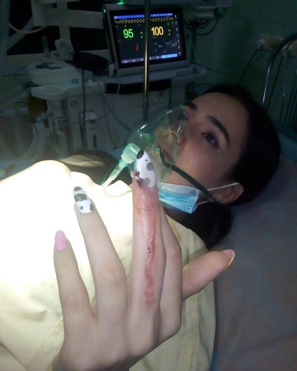 Анна Тринчер показала окровавленный палец и рассказала, что произошло (Instagram Анны Тринчер)