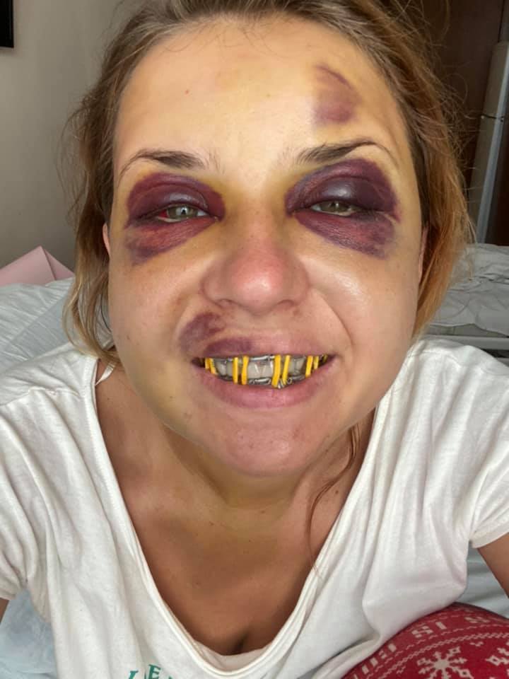 Анастасія Лугова після операції