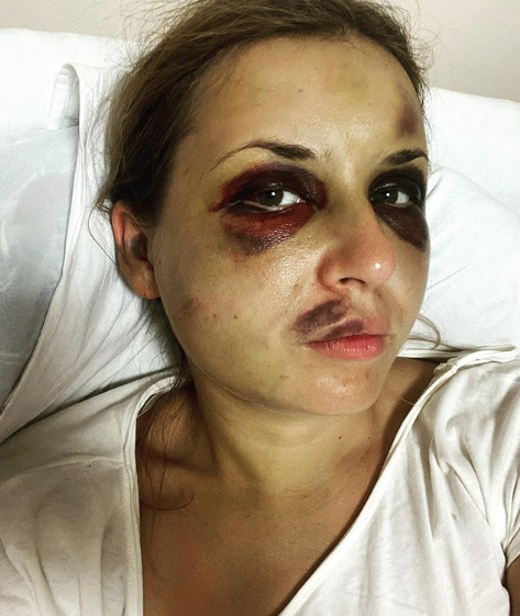 Анастасія Лугова поскаржилася на погіршення самопочуття після нападу в потязі