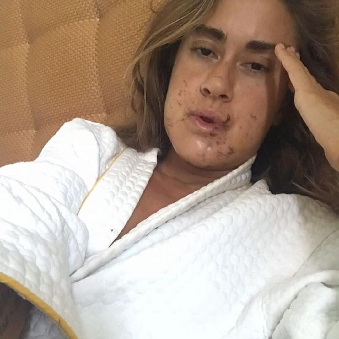 Донька Успенської показала обличчя після аварії (Instagram Тетяни Плаксіної)