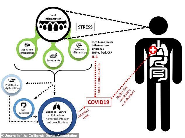 Як захворювання ясен позначаються на здоров'ї пацієнтів із коронавірусом