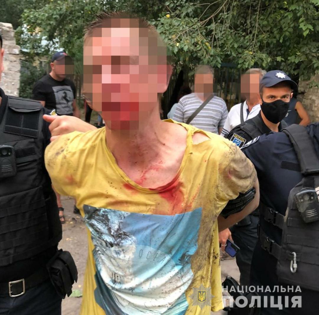 У Дніпрі чоловік кинув гранату в людей. Фото пресслужби ГУ НП в Дніпропетровській області