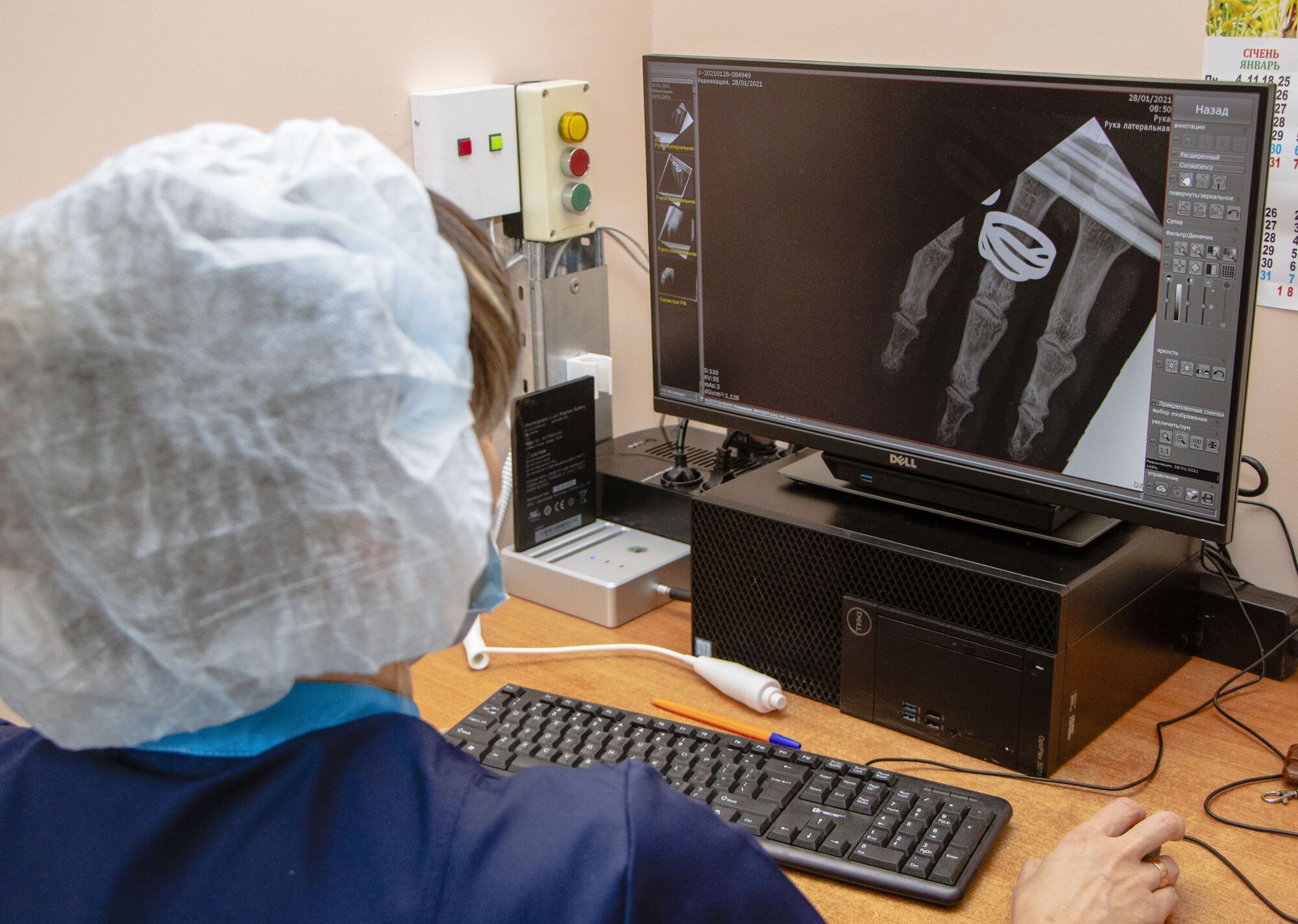 В городской клинической больнице № 6 появился цифровой рентгенаппарат