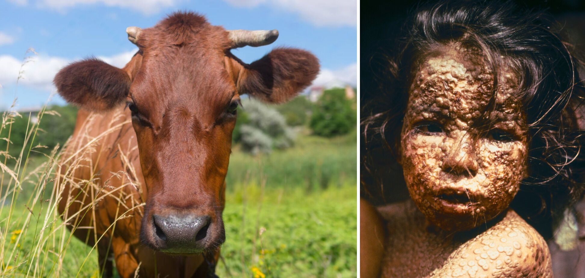 В течение многих столетий люди искали лекарство от оспы и в итоге нашли – благодаря коровам