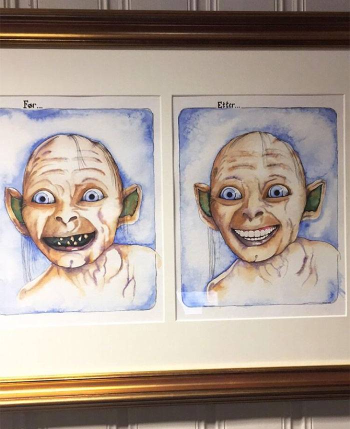Стоматолог повесил картинку до и после.