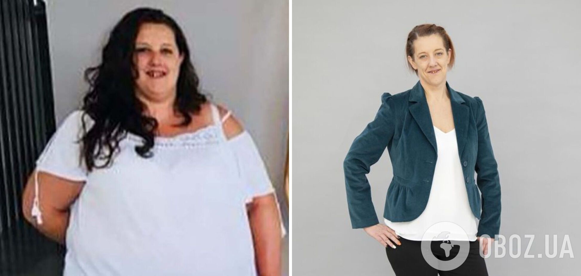 Англичанка Сара Купер до и после похудения.
