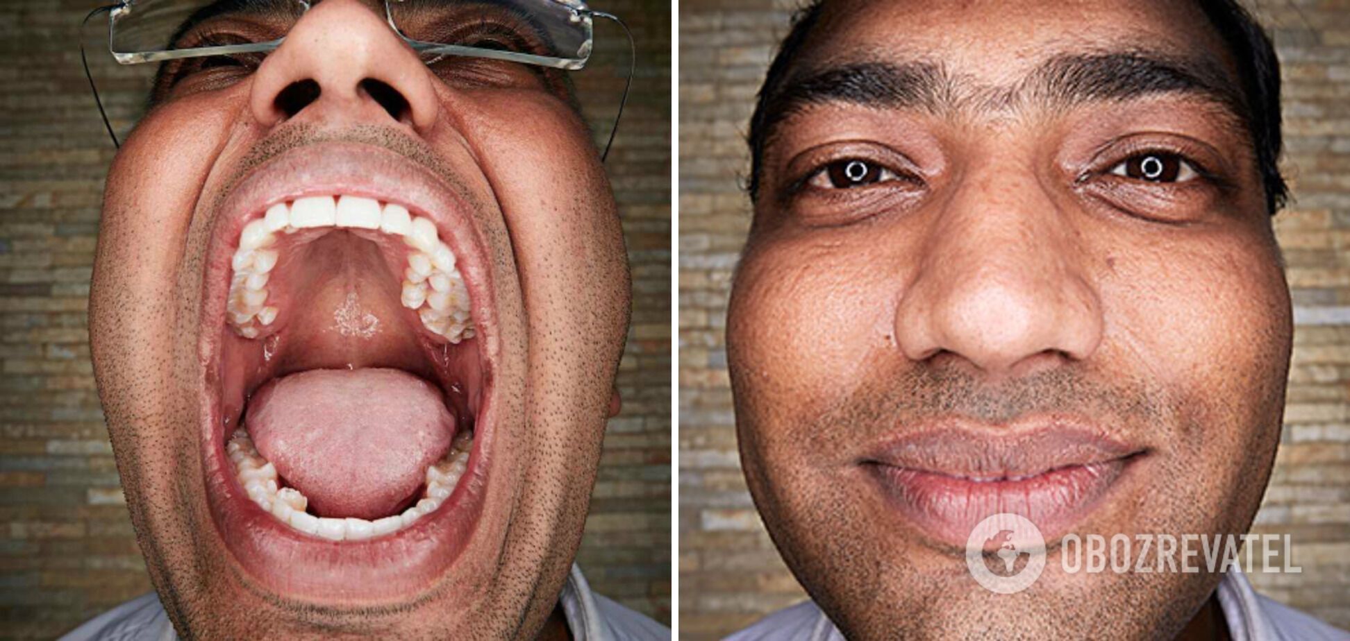 У Виджея Кумара 37 зубов.