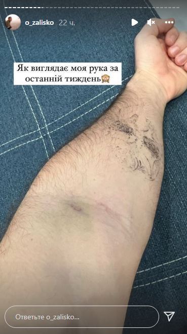 После случившегося блогеру ставили капельницы