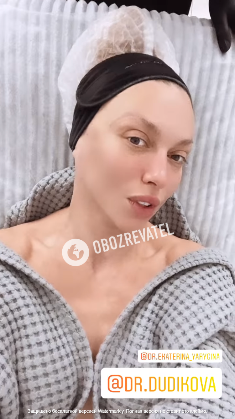 Оля Полякова без макияжа